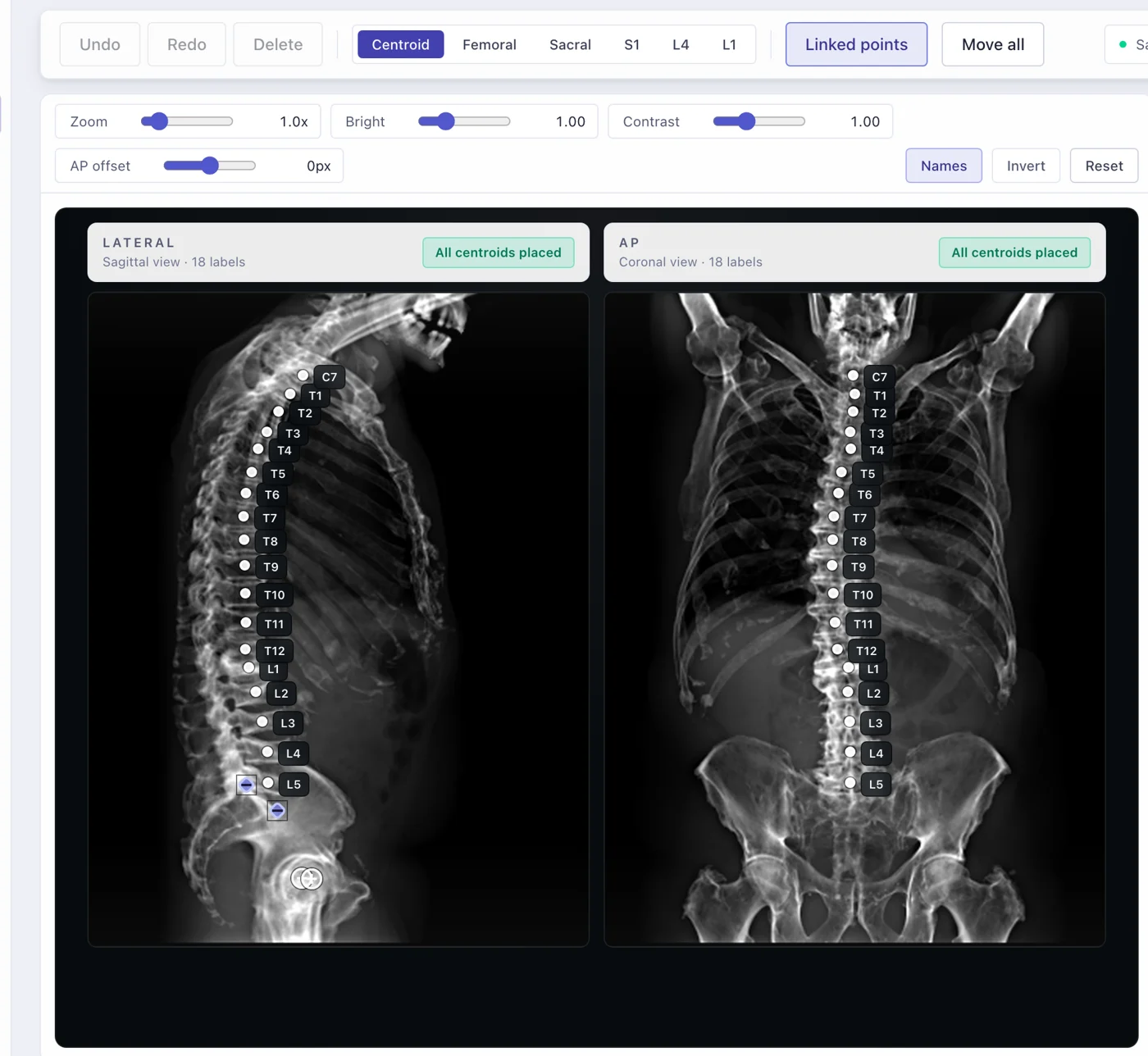Zyra landmarking view: lateral and frontal radiographs with vertebral centroids labelled from C7 to L5